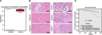 LINC00470 Stimulates Methylation of PTEN to Facilitate the Progression of Endometrial Cancer by Recruiting DNMT3a Through MYC